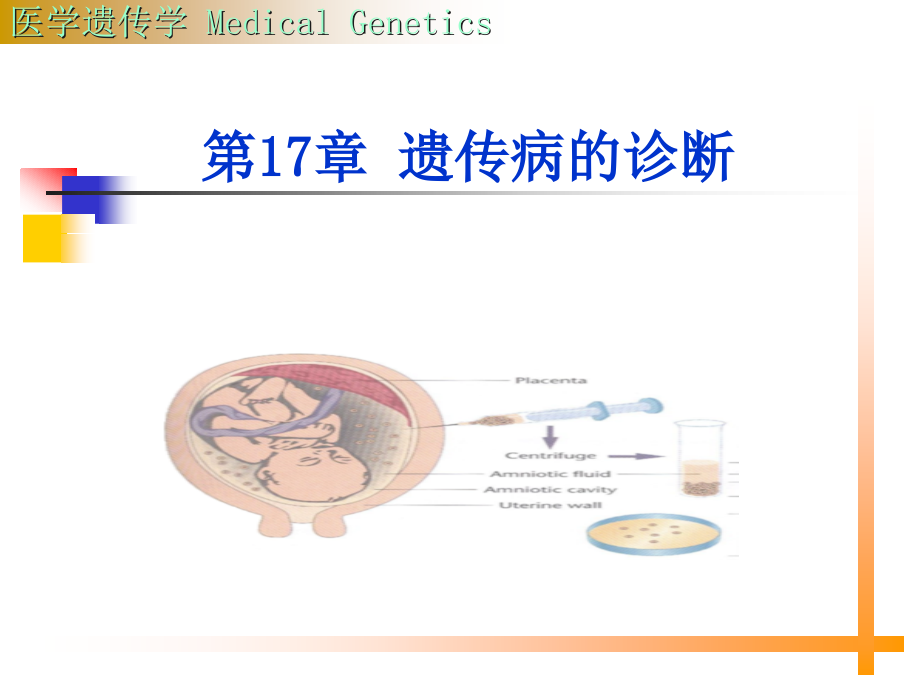 遗传病的诊断和治疗lsy课件_第1页