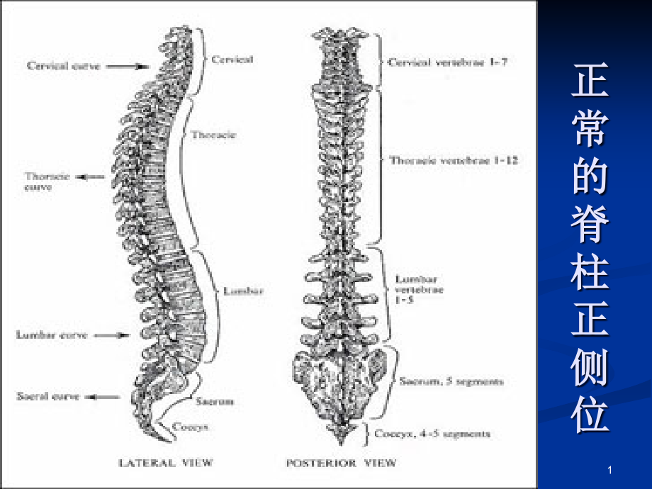 脊柱矫形器专业知识讲座主题讲座ppt课件_第1页