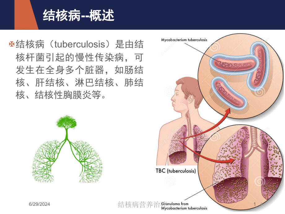 结核病营养治疗培训ppt课件_第1页