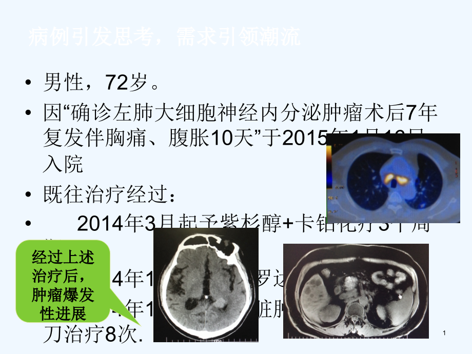 肺癌免疫靶向治疗课件_第1页