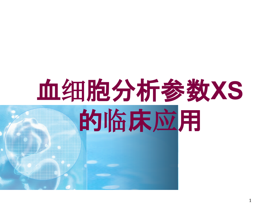 血细胞分析参数XS的临床应用培训ppt课件_第1页