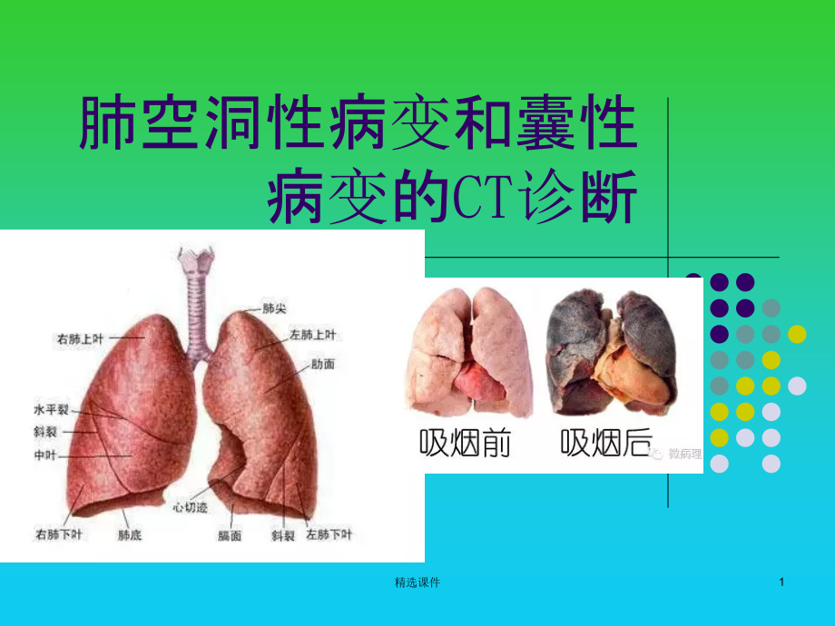 肺空洞性病变和囊性病变的CT诊断课件_第1页