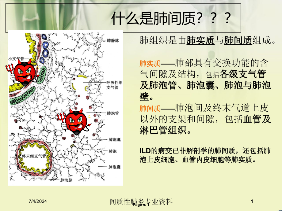 间质性肺炎专业资料培训ppt课件_第1页