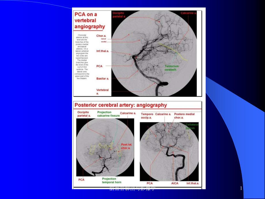 脑血管解剖与影像学ppt课件_第1页