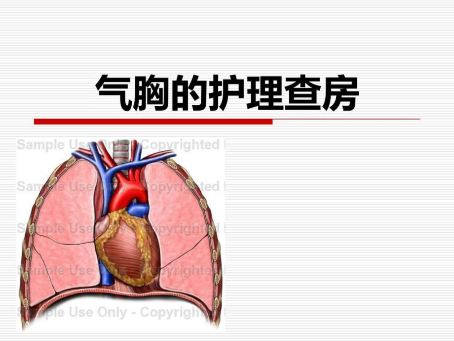 气胸的护理查房图课件_第1页