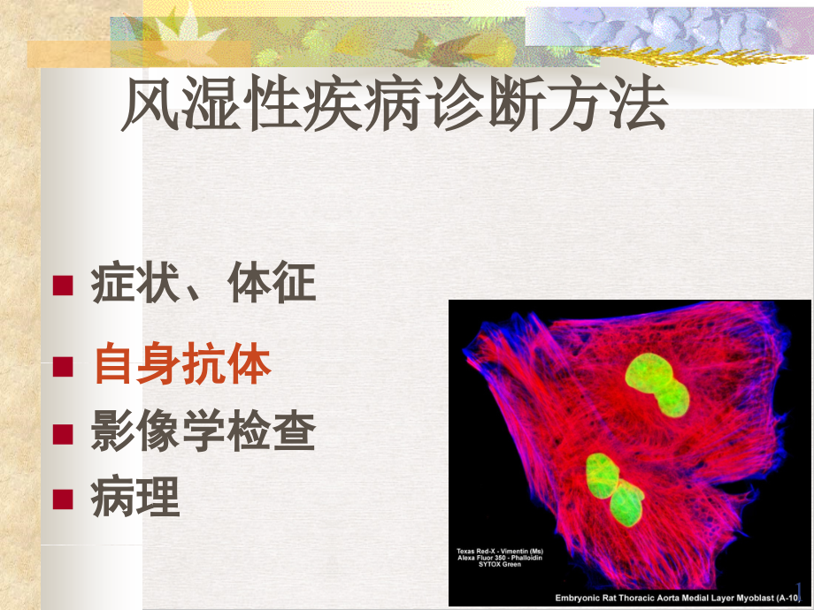 风湿性疾病中自身抗体的意义课件_第1页