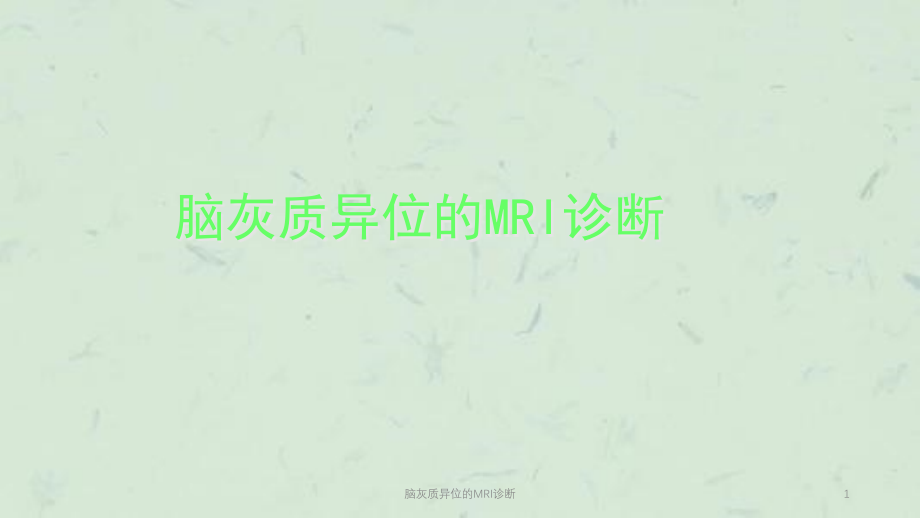 脑灰质异位的MRI诊断ppt课件_第1页