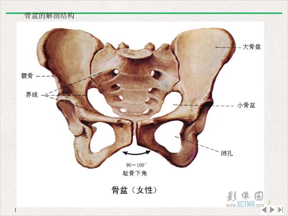 骨盆骨折的并发症护理公开课课件_第1页