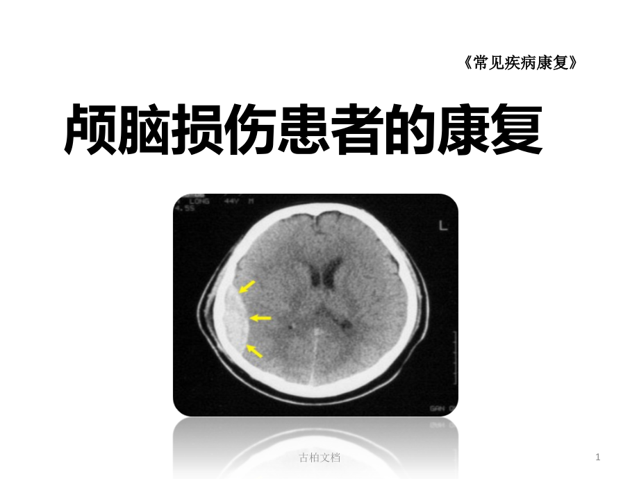 颅脑损伤康复(岩)(特制研究)课件_第1页