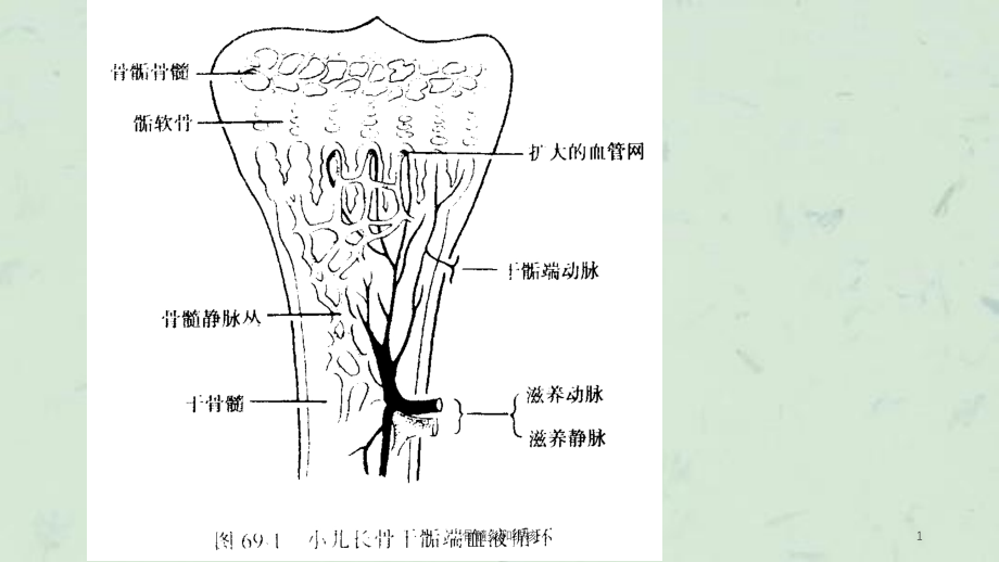 骨髓炎和结核ppt课件_第1页