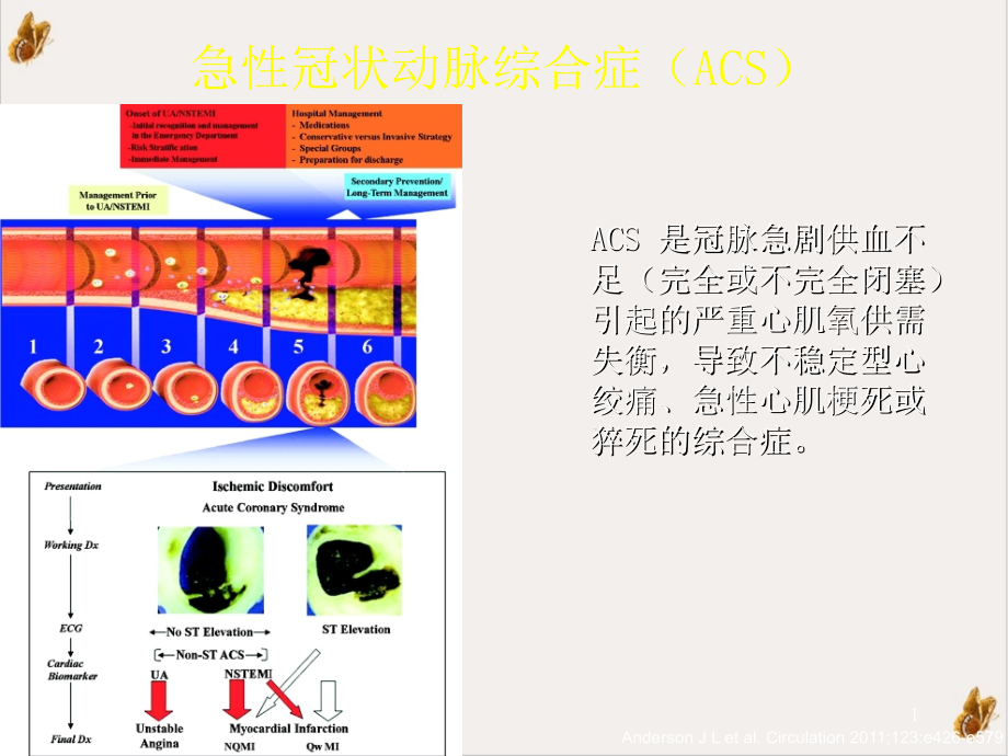 非st段抬网高acs危险评估及治疗策略ppt课件_第1页