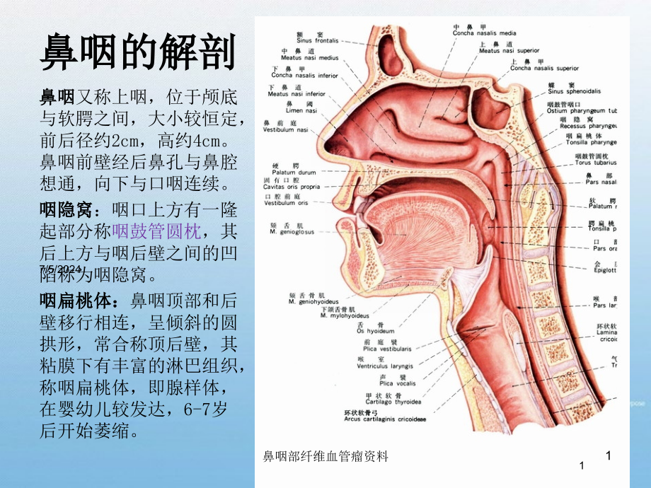 鼻咽部纤维血管瘤资料培训ppt课件_第1页