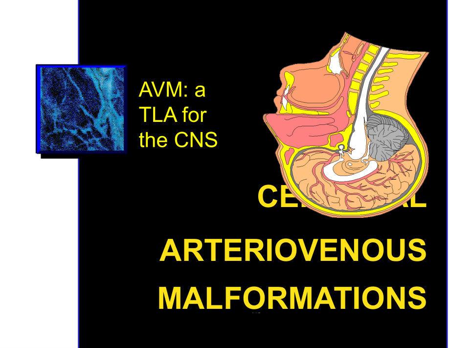 脑动静脉畸形医药类ppt课件_第1页