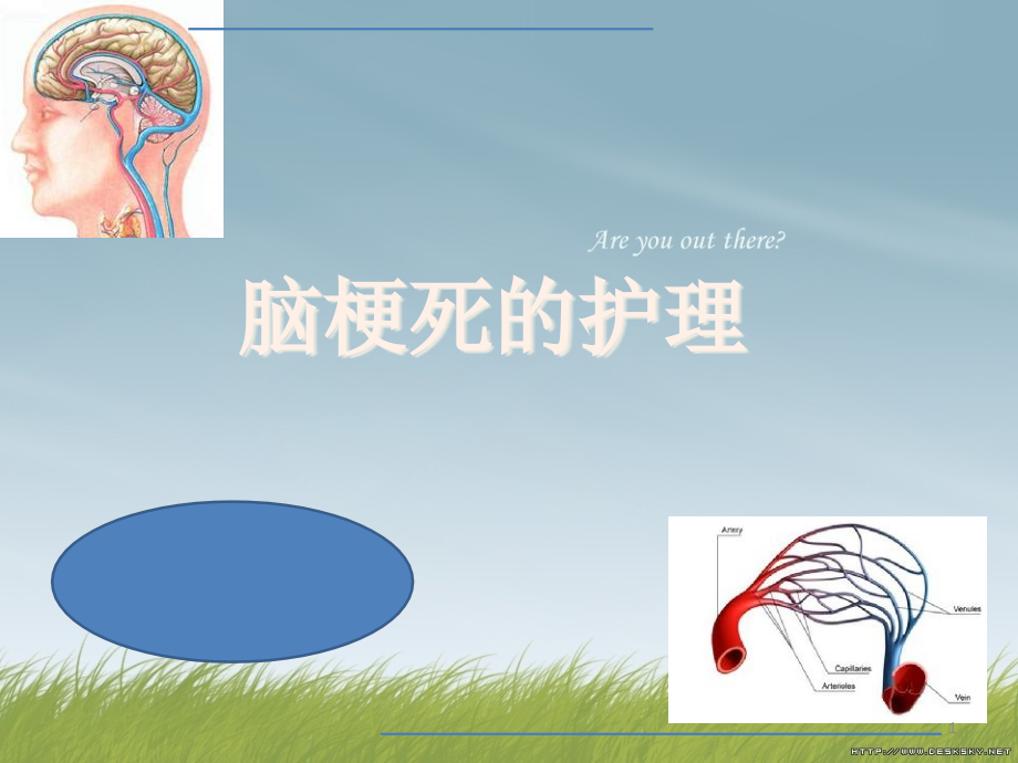 脑梗死护理内容课件_第1页