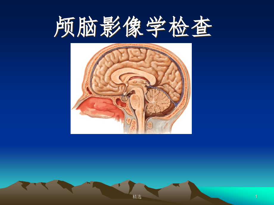 颅脑影像学检查-课件_第1页