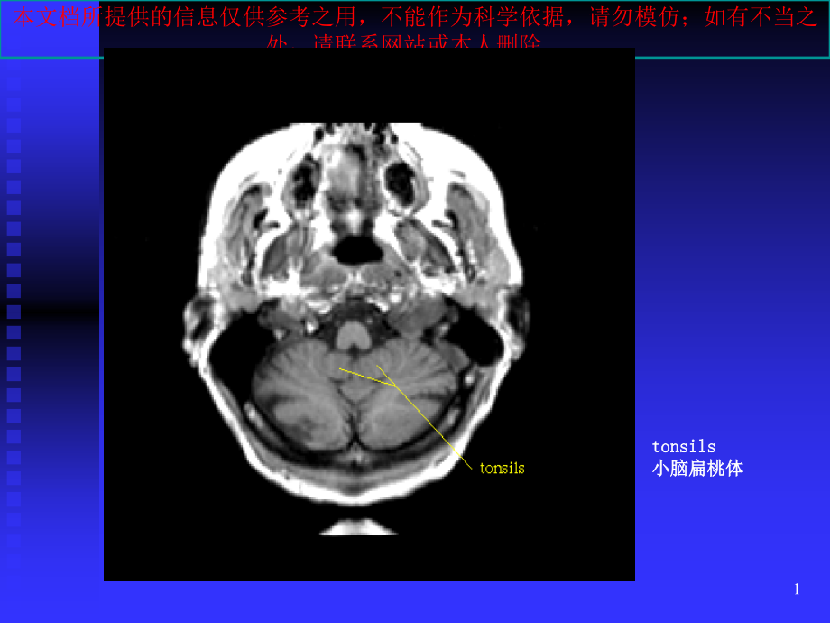 颅脑磁共振影像辨识培训ppt课件_第1页