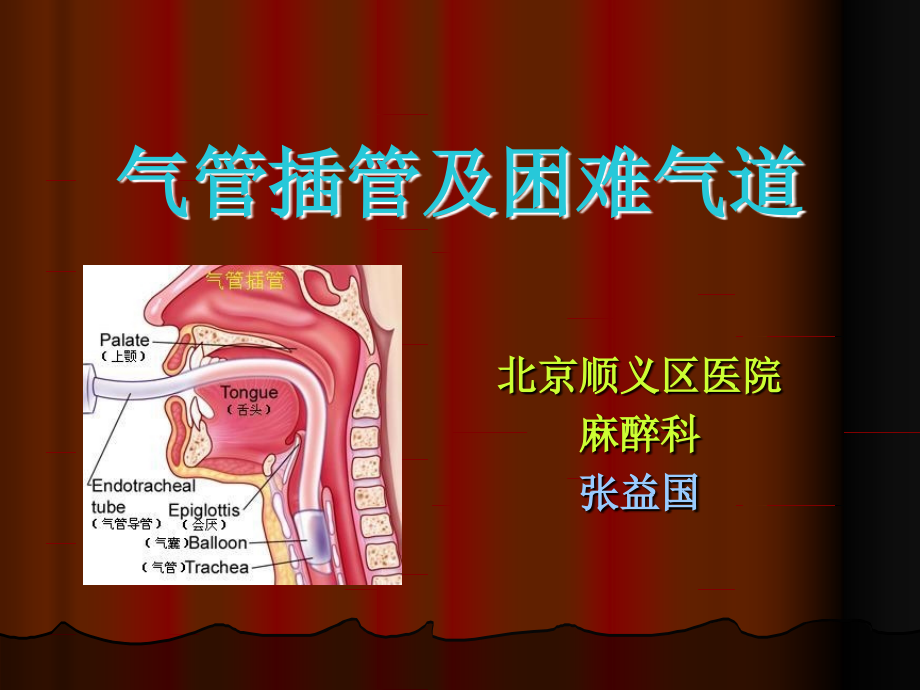 气管插管技术资料课件_第1页