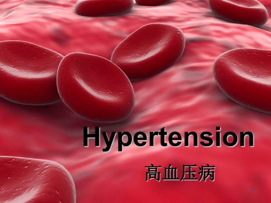 英文疾病介绍——Hypertension(高血压病)参考课件_第1页