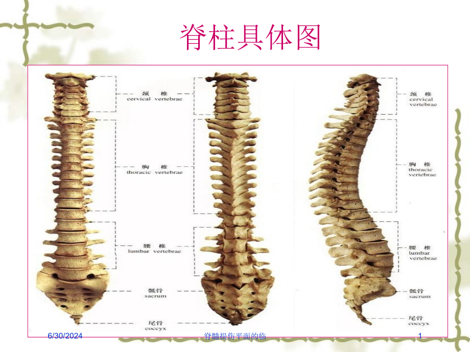 脊髓损伤平面的临培训ppt课件_第1页