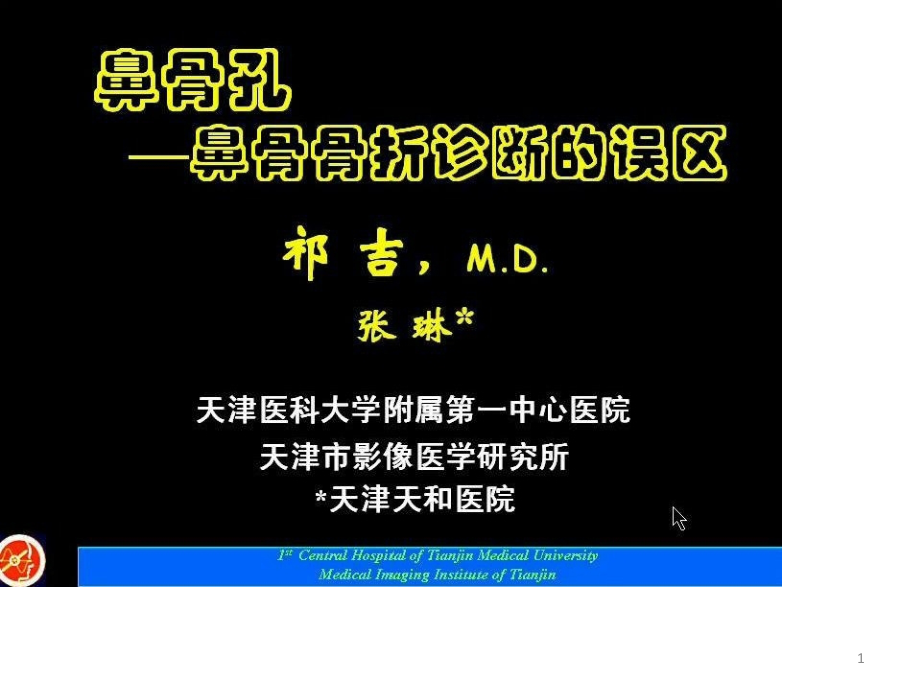 鼻骨孔鼻骨骨折诊断的误区及临床课件_第1页