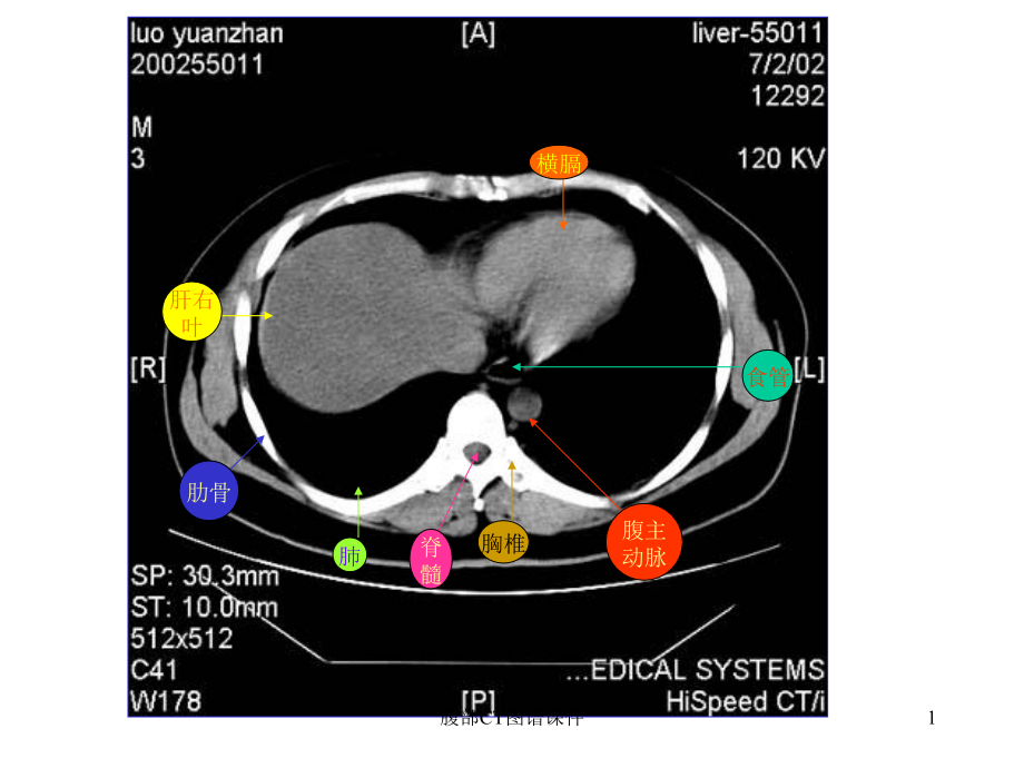 腹部CT图谱ppt课件_第1页