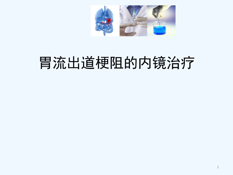 胃流出道梗阻的内镜治疗课件_第1页