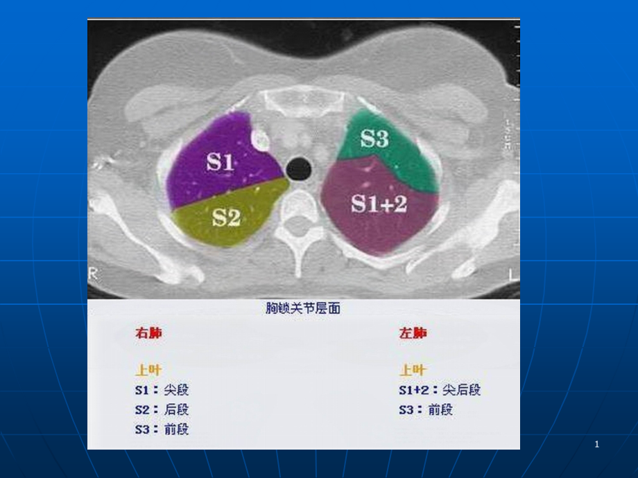 胸部CT肺段图解ppt课件_第1页