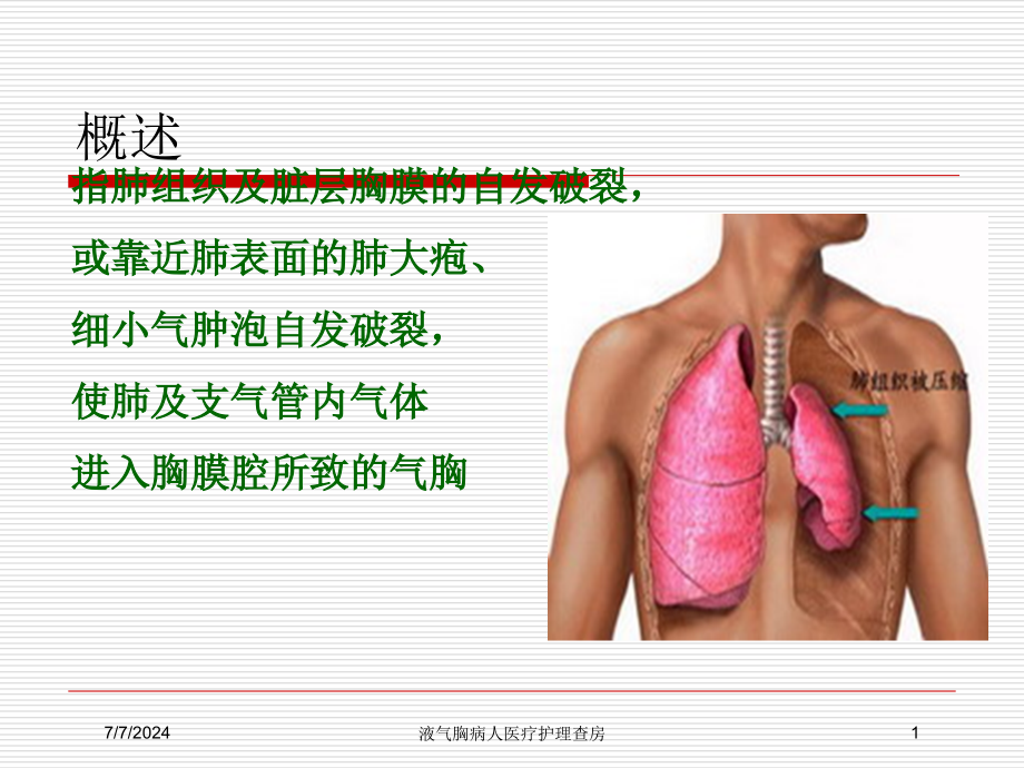 液气胸病人医疗护理查房培训课件_第1页