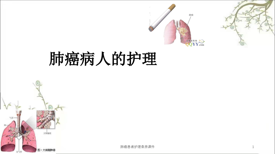 肺癌患者护理查房ppt课件_第1页