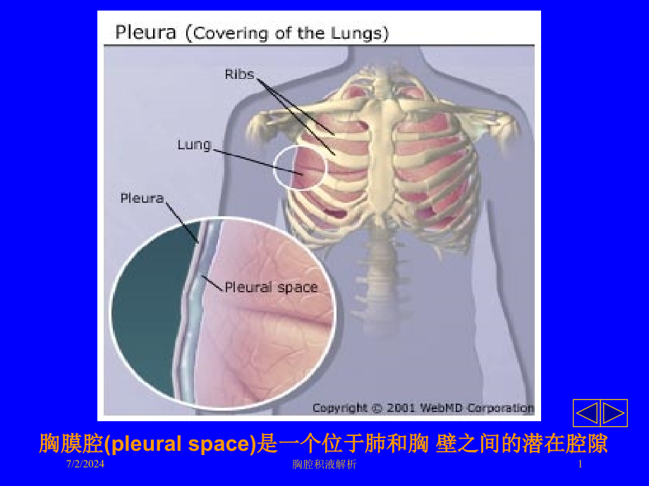 胸腔积液解析培训ppt课件_第1页