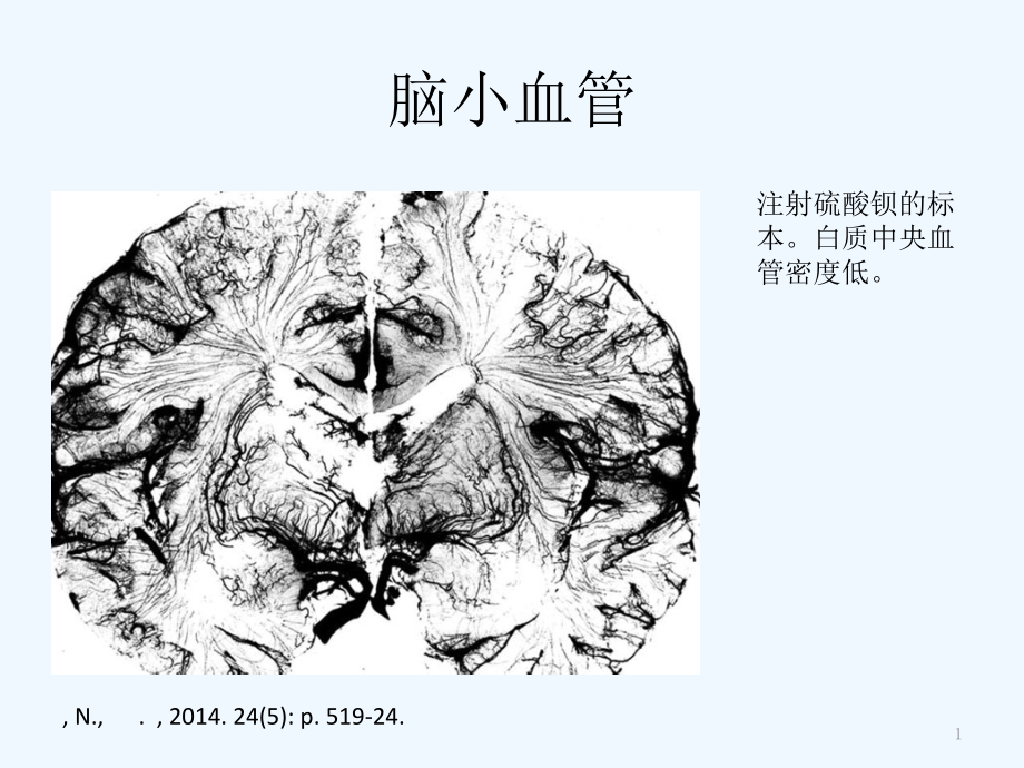 脑小血管病概念与治疗课件_第1页