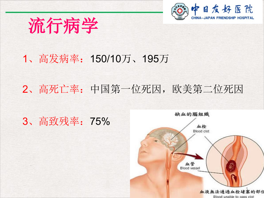 静脉溶栓的护理ppt课件完整版_第1页