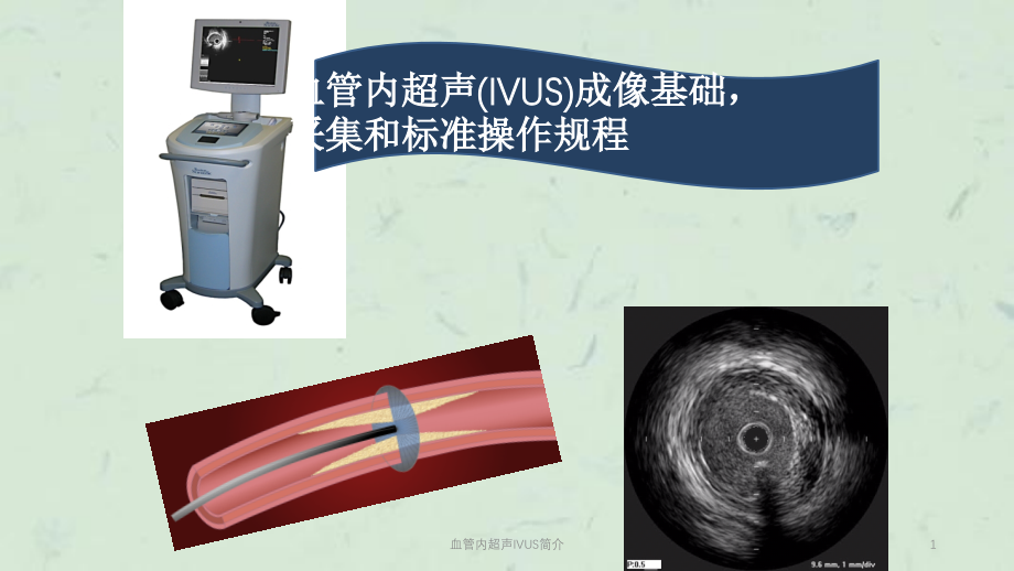 血管内超声IVUS简介ppt课件_第1页