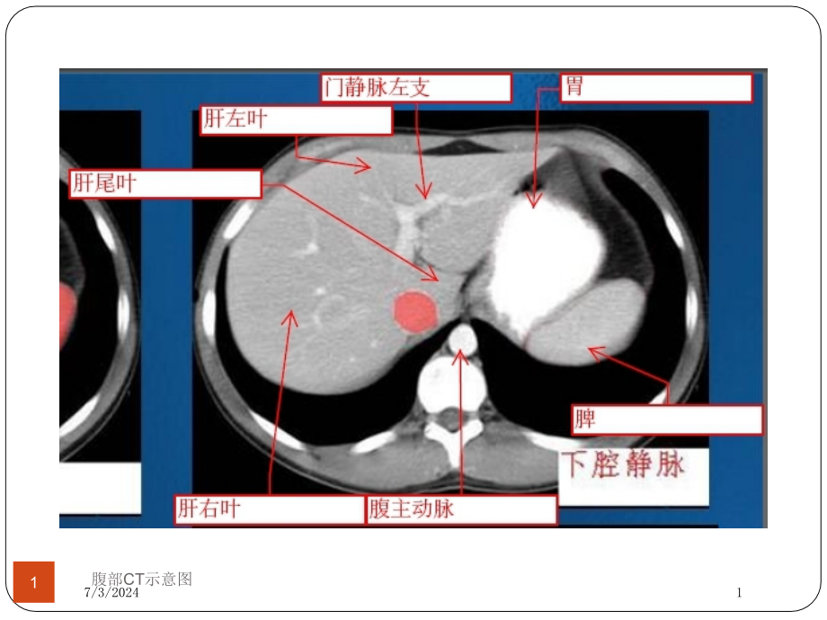 腹部CT示意图培训ppt课件_第1页