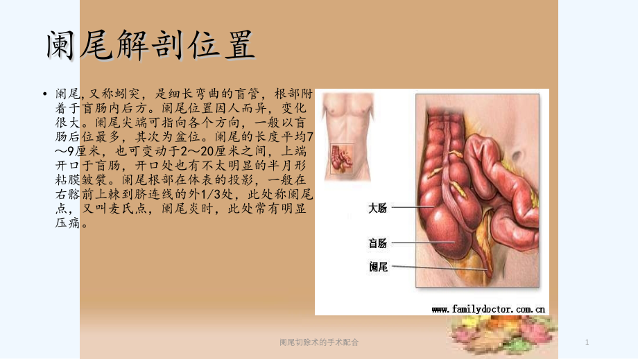 阑尾切除术的手术配合ppt课件_第1页