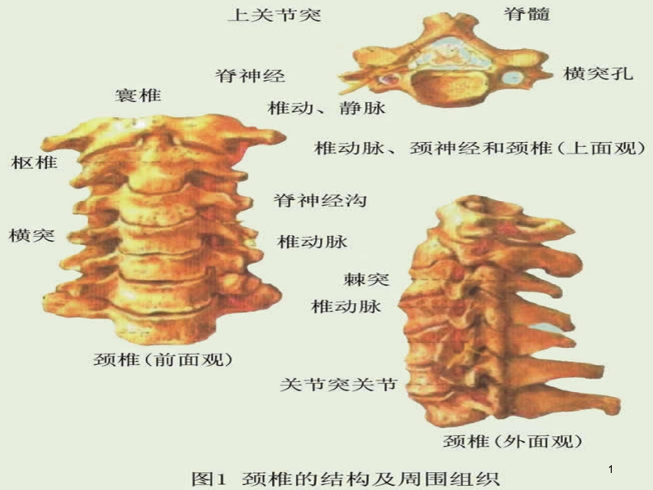 颈椎X线诊断判断椎体退变新版课件_第1页