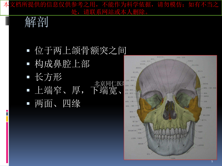 鼻骨骨折影像学诊疗和鉴别培训ppt课件_第1页