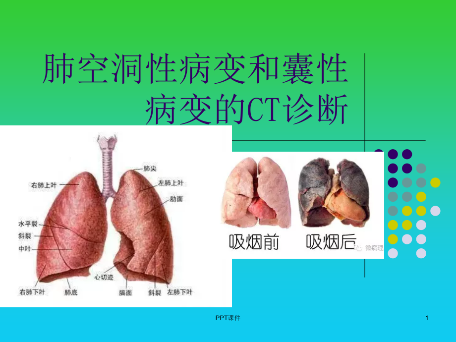 肺空洞性病变和囊性病变的CT诊断--课件_第1页