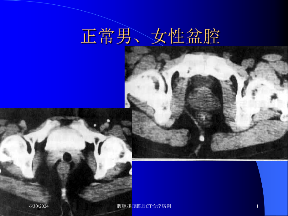 腹腔和腹膜后CT诊疗病例培训ppt课件_第1页