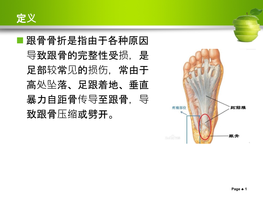 跟骨骨折护理查房实用课件_第1页