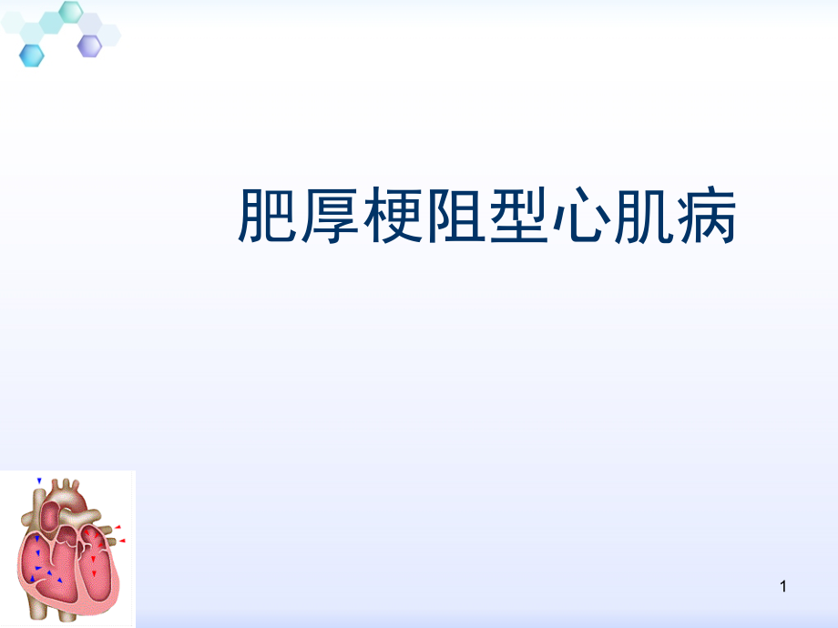 肥厚梗阻型心肌病医学ppt课件_第1页