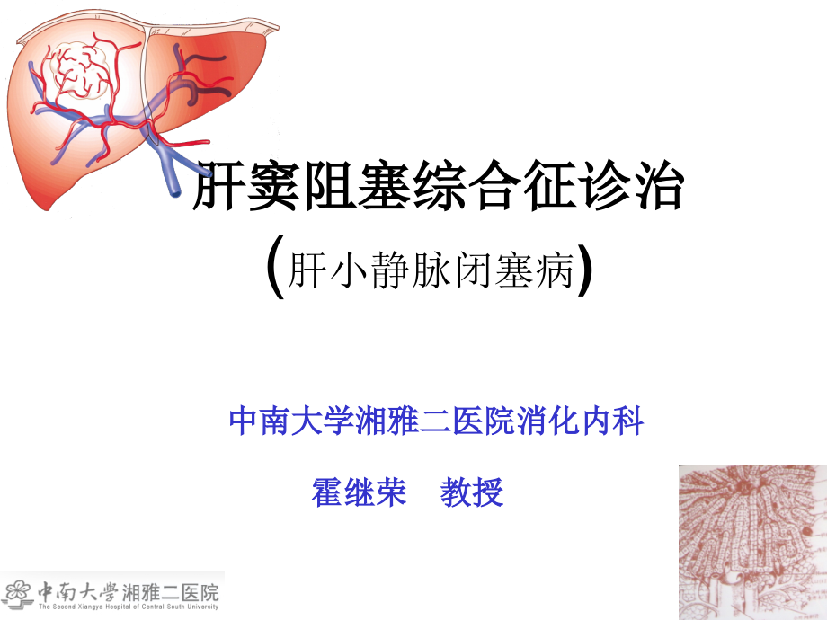 肝窦阻塞综合征诊治课件_第1页