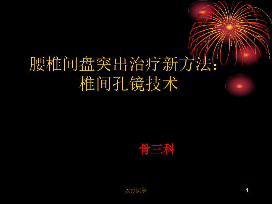 腰椎间盘突出治疗新方法：椎间孔镜技术(行业运用)课件_第1页