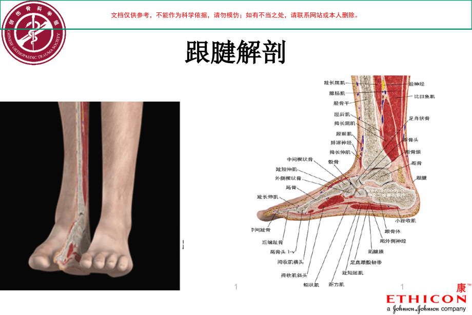 跟腱断裂术后康复流程图ppt课件_第1页