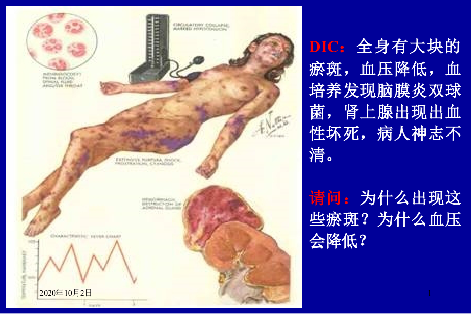 疾病概论-病理学课件_第1页