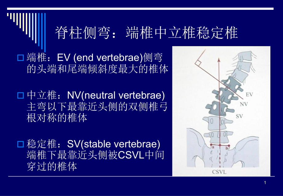 脊柱侧弯基础知识课件_第1页