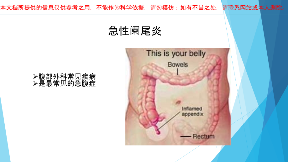 急性阑尾炎专题知识宣讲培训ppt课件_第1页