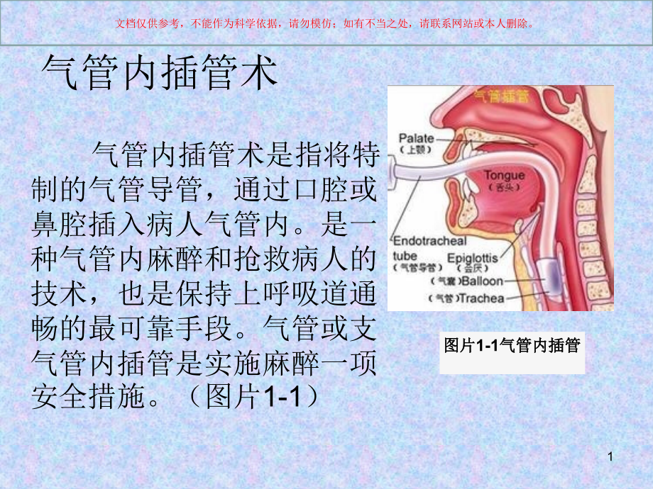 气管插管术培训培训ppt课件_第1页