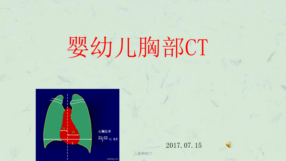 儿童胸部CTppt课件_第1页