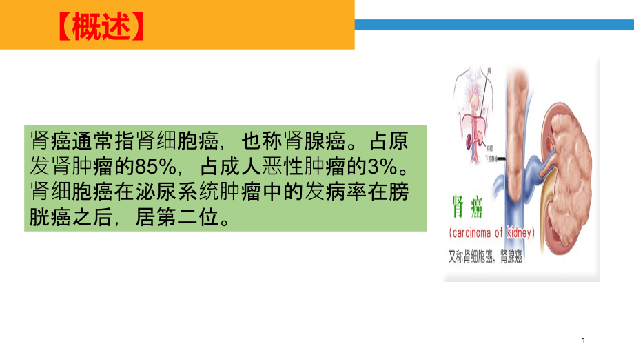 医学ppt课件肾癌病人的医疗护理_第1页